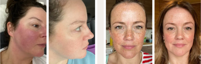 Dermatica skincare examples from previous customers who used the products