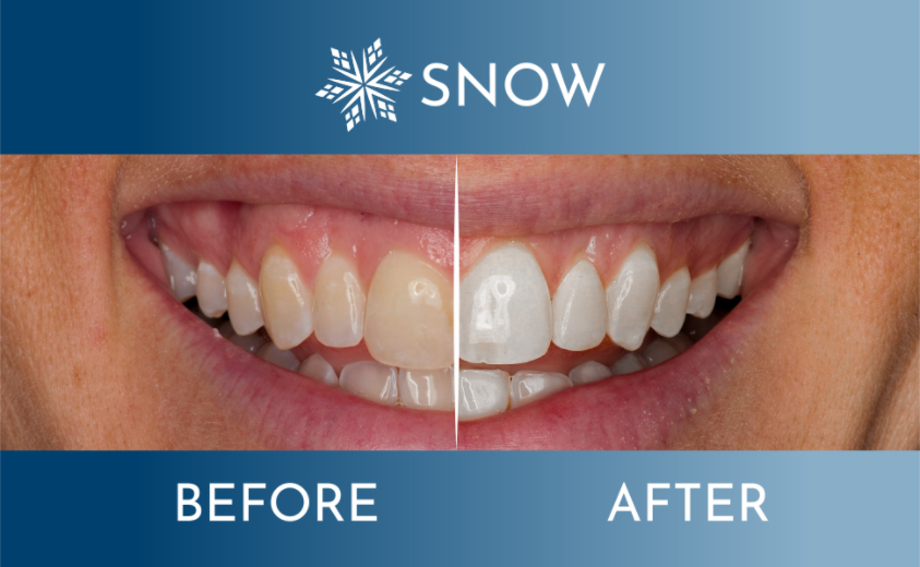 About Snow Homepage