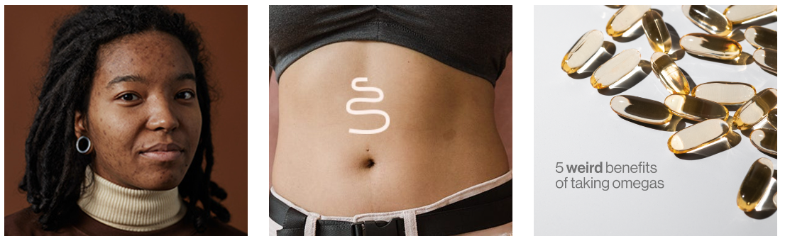 Get Advanced Nutrition supplements and clear your skin