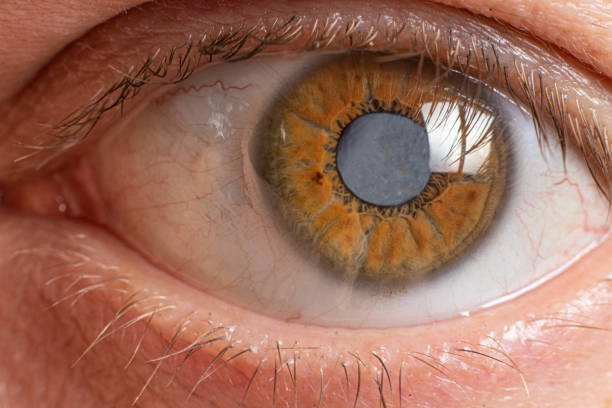 eyes